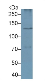PLCB4 Antibody in Western Blot (WB)