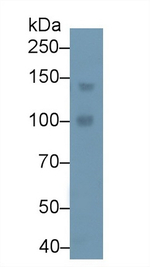 PLCB4 Polyclonal Antibody