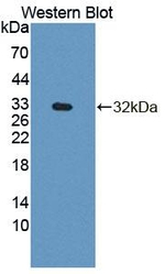PLCB4 Antibody in Western Blot (WB)
