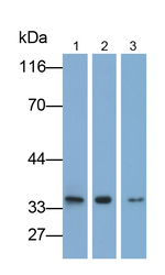 VDAC Antibody in Western Blot (WB)
