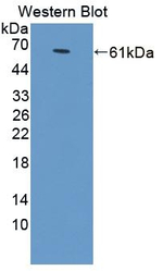 VDAC Antibody in Western Blot (WB)