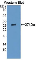 IL-12 p35 Antibody in Western Blot (WB)