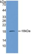 SDHD Antibody in Western Blot (WB)