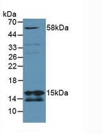 SDHD Antibody in Western Blot (WB)
