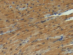 S100A1 Antibody in Immunohistochemistry (Paraffin) (IHC (P))