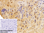 S100A1 Antibody in Immunohistochemistry (Paraffin) (IHC (P))