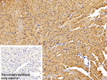 S100A1 Antibody in Immunohistochemistry (Paraffin) (IHC (P))