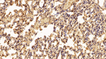 Interferon alpha-2 Antibody in Immunohistochemistry (Paraffin) (IHC (P))