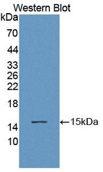 ACYP1 Antibody in Western Blot (WB)