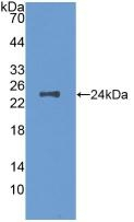 M-CSF Antibody in Western Blot (WB)