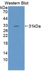 VARS Antibody in Western Blot (WB)