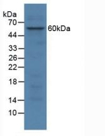 SGSH Antibody in Western Blot (WB)