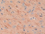 MEPE Polyclonal Antibody