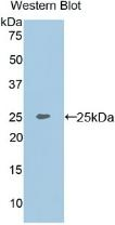 MEPE Antibody in Western Blot (WB)