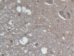 GLRA2 Polyclonal Antibody