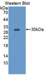 GLRA2 Antibody in Western Blot (WB)