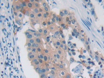 PAFAH2 Antibody in Immunohistochemistry (Paraffin) (IHC (P))