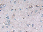 PAFAH2 Antibody in Immunohistochemistry (Paraffin) (IHC (P))