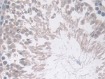 COX1 Polyclonal Antibody