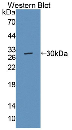MRP6 Antibody in Western Blot (WB)