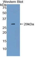 14-3-3 sigma Antibody in Western Blot (WB)