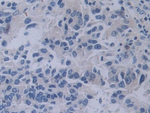 YARS Antibody in Immunohistochemistry (Paraffin) (IHC (P))
