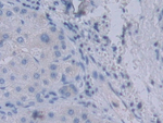 YARS Antibody in Immunohistochemistry (Paraffin) (IHC (P))