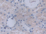 YARS Antibody in Immunohistochemistry (Paraffin) (IHC (P))
