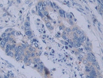 YARS Antibody in Immunohistochemistry (Paraffin) (IHC (P))