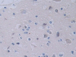 YARS Antibody in Immunohistochemistry (Paraffin) (IHC (P))