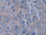 YARS Antibody in Immunohistochemistry (Paraffin) (IHC (P))