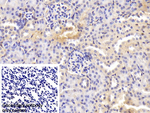 Transferrin Polyclonal Antibody