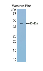 Transferrin Antibody in Western Blot (WB)
