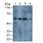 Carbonic Anhydrase IX Antibody in Western Blot (WB)