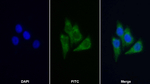 ACAT1 Antibody in Immunocytochemistry (ICC/IF)