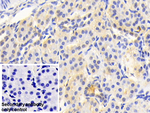 ACAT1 Antibody in Immunohistochemistry (Paraffin) (IHC (P))