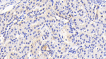 ACAT1 Antibody in Immunohistochemistry (Paraffin) (IHC (P))