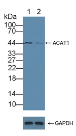 ACAT1 Antibody in Western Blot (WB)