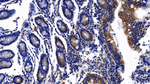 EPB41 Polyclonal Antibody