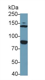 EPB41 Antibody in Western Blot (WB)