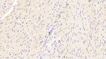 Laminin alpha-2 Antibody in Immunohistochemistry (Paraffin) (IHC (P))