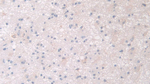PANK4 Antibody in Immunohistochemistry (Paraffin) (IHC (P))