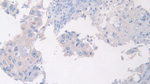 PANK4 Polyclonal Antibody