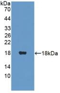 PANK4 Antibody in Western Blot (WB)