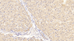 NOTCH2 Polyclonal Antibody