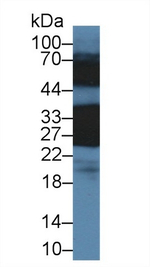 CRYBB1 Antibody in Western Blot (WB)