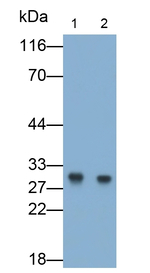CRYBB1 Antibody in Western Blot (WB)