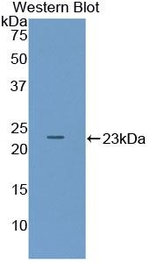 PACAP-38 Antibody in Western Blot (WB)