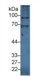 ITIH2 Antibody in Western Blot (WB)