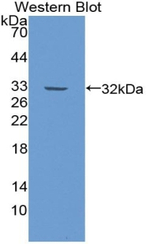 ITIH2 Antibody in Western Blot (WB)